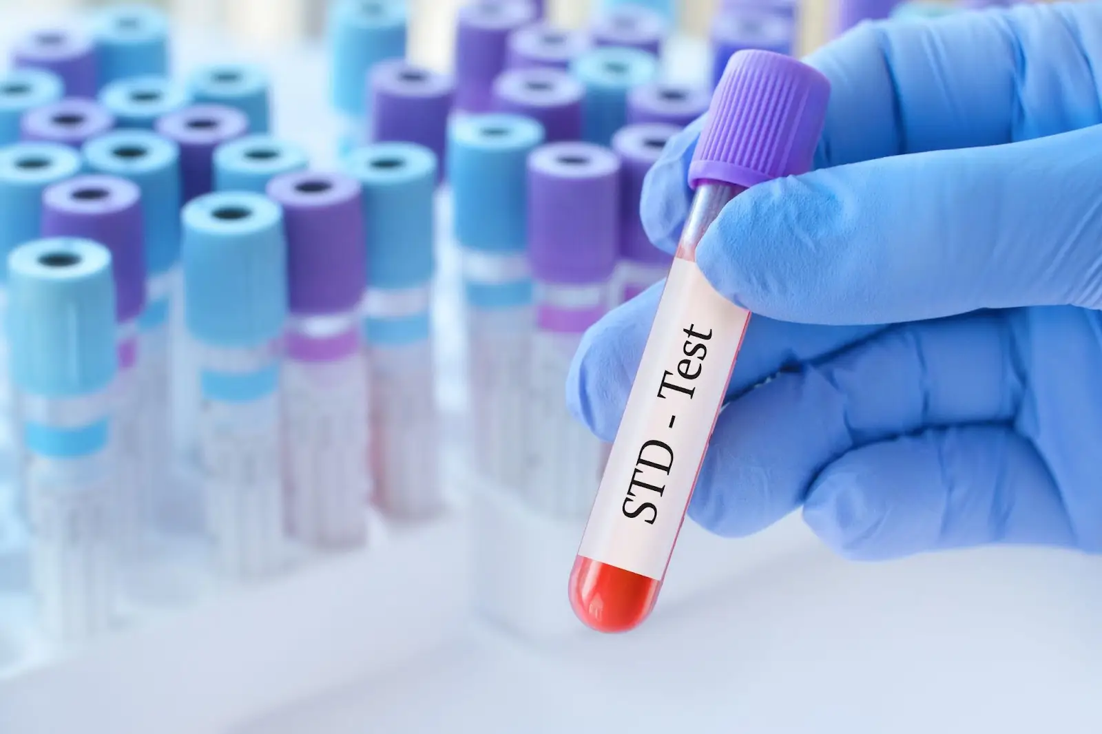 STD Test At Dubai Life Aid
